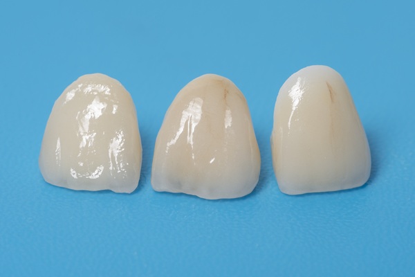 CEREC® Crowns Vs  Traditional Dental Crowns