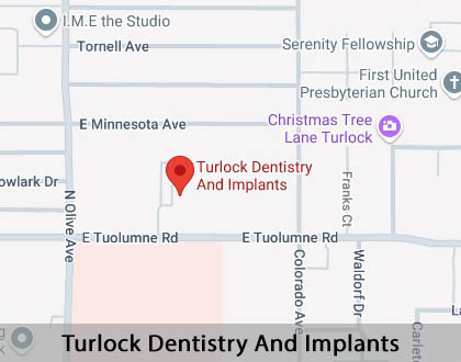 Map image for Oral Surgery in Turlock, CA