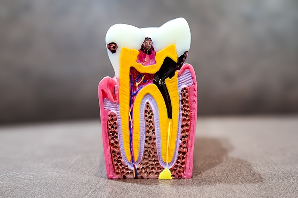 Pain And Root Canals: What You Should Know