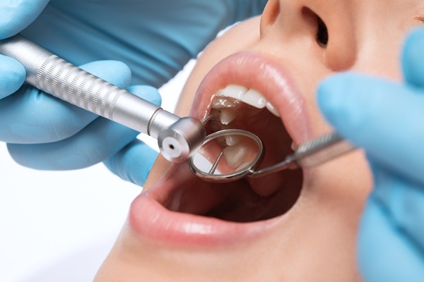 How A Tooth Filling Is Done